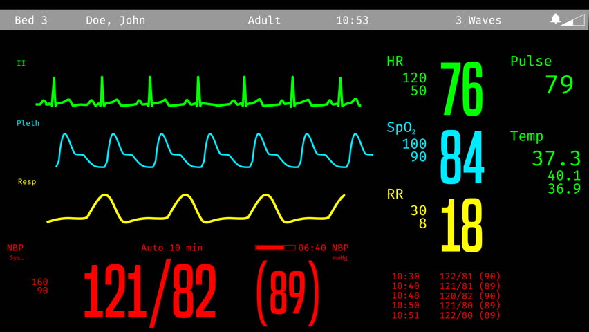 Icu monitor